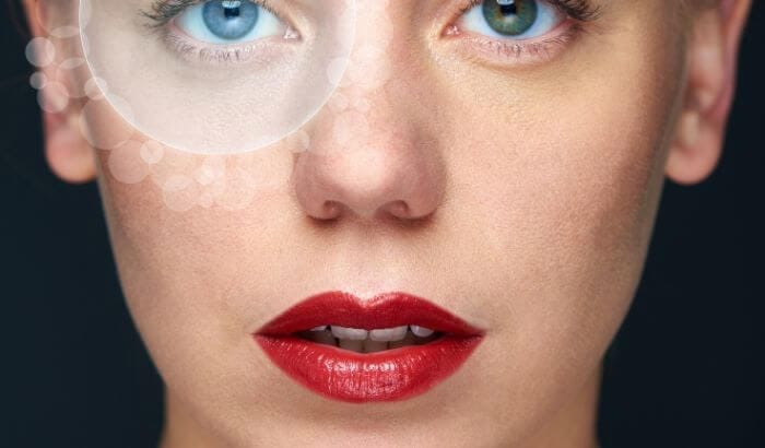 heterocromia central